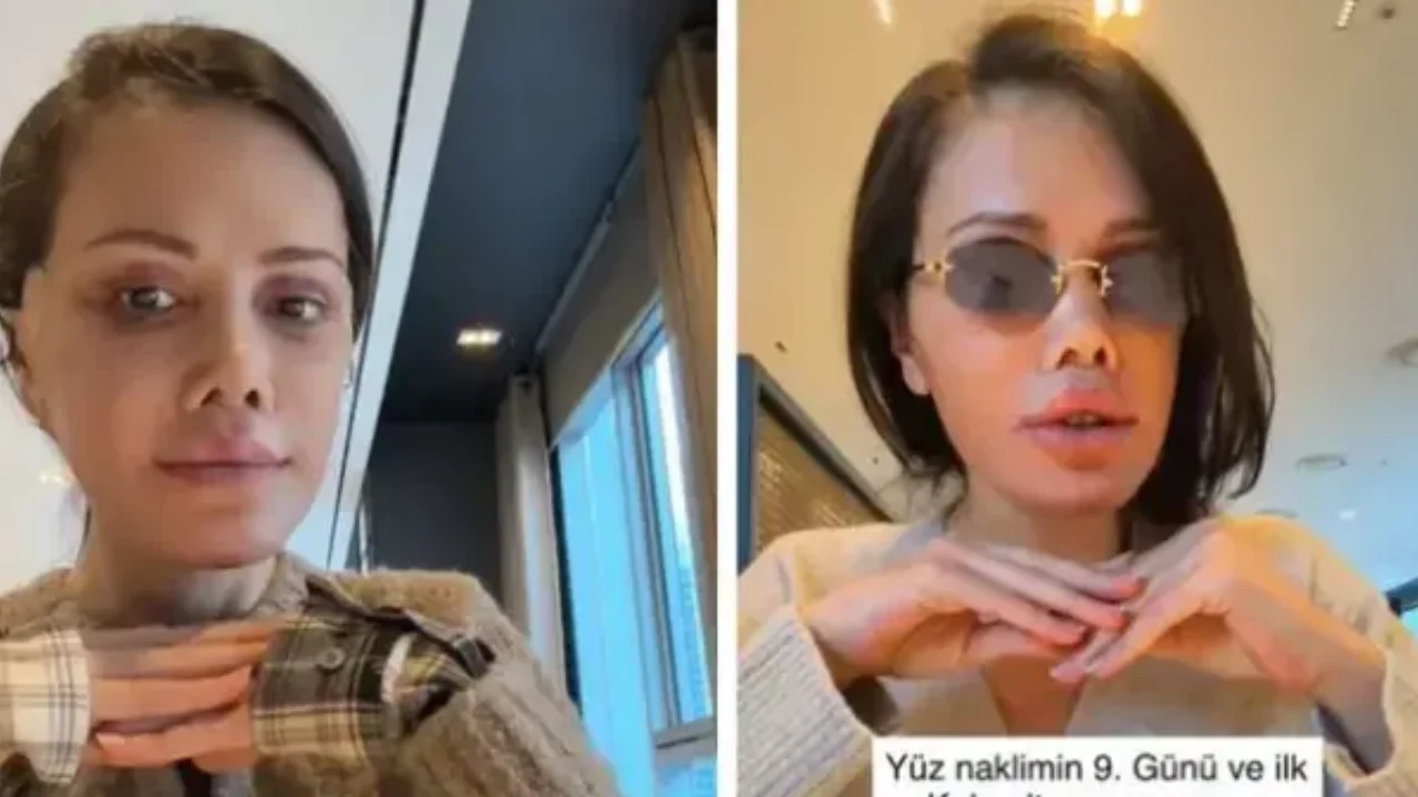 Survivor Didem Ceran Yeniden Gündemde: Estetik Süreci, Yaşı ve Son Hali Merak Konusu